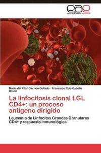 bokomslag La linfocitosis clonal LGL CD4+