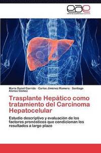 bokomslag Trasplante Heptico como tratamiento del Carcinoma Hepatocelular