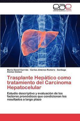 Trasplante Heptico como tratamiento del Carcinoma Hepatocelular 1