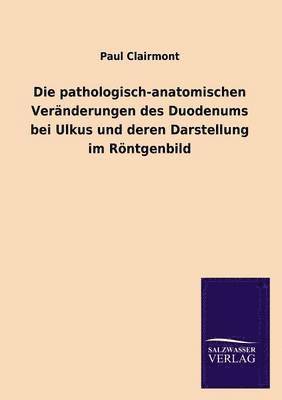 Pathologisch-Anatomischen Veranderungen Des Duodenums Bei Ulkus Und Deren Darstellung Im Rontgenbild