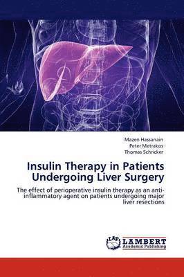 Insulin Therapy in Patients Undergoing Liver Surgery 1
