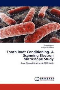 bokomslag Tooth Root Conditioning- A Scanning Electron Microscope Study