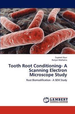Tooth Root Conditioning- A Scanning Electron Microscope Study 1