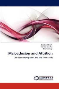 bokomslag Malocclusion and Attrition