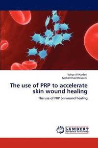 bokomslag The use of PRP to accelerate skin wound healing