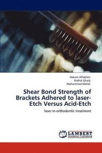 bokomslag Shear Bond Strength of Brackets Adhered to laser-Etch Versus Acid-Etch