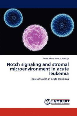 Notch Signaling and Stromal Microenvironment in Acute Leukemia 1