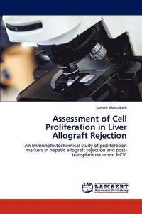 bokomslag Assessment of Cell Proliferation in Liver Allograft Rejection