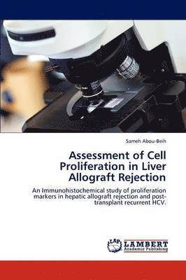 Assessment of Cell Proliferation in Liver Allograft Rejection 1