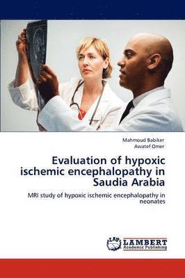 Evaluation of hypoxic ischemic encephalopathy in Saudia Arabia 1