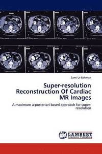 bokomslag Super-resolution Reconstruction Of Cardiac MR Images