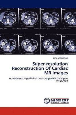 Super-resolution Reconstruction Of Cardiac MR Images 1