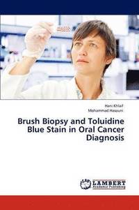bokomslag Brush Biopsy and Toluidine Blue Stain in Oral Cancer Diagnosis