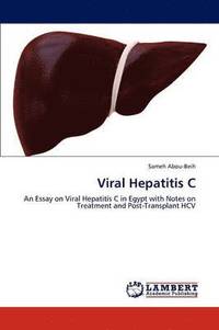 bokomslag Viral Hepatitis C