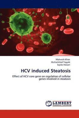 Hcv Induced Steatosis 1