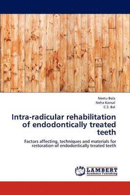 Intra-radicular rehabilitation of endodontically treated teeth 1