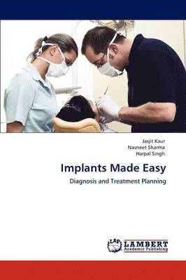 Implants Made Easy 1