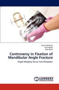 bokomslag Controversy in Fixation of Mandibular Angle Fracture