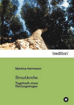 bokomslag Brustkrebs