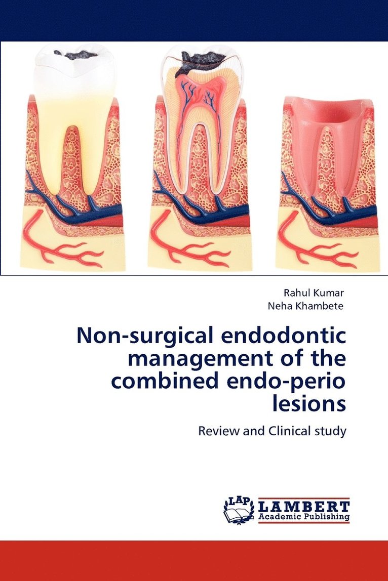 Non-surgical endodontic management of the combined endo-perio lesions 1