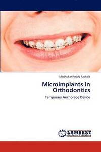 bokomslag Microimplants in Orthodontics