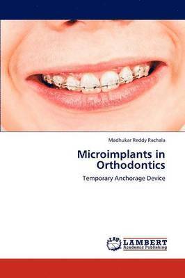 Microimplants in Orthodontics 1