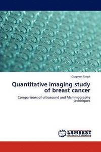 bokomslag Quantitative imaging study of breast cancer