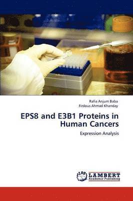 Eps8 and E3b1 Proteins in Human Cancers 1