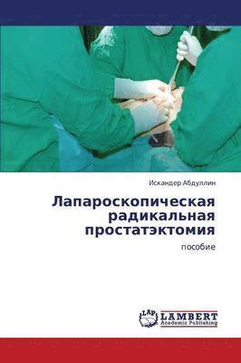 Laparoskopicheskaya Radikal'naya Prostatektomiya 1