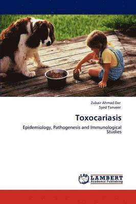 Toxocariasis 1