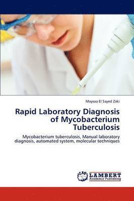 Rapid Laboratory Diagnosis of Mycobacterium Tuberculosis 1