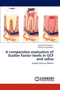 bokomslag A comparative evaluation of Scatter Factor levels in GCF and saliva