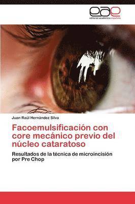 bokomslag Facoemulsificacin con core mecnico previo del ncleo cataratoso