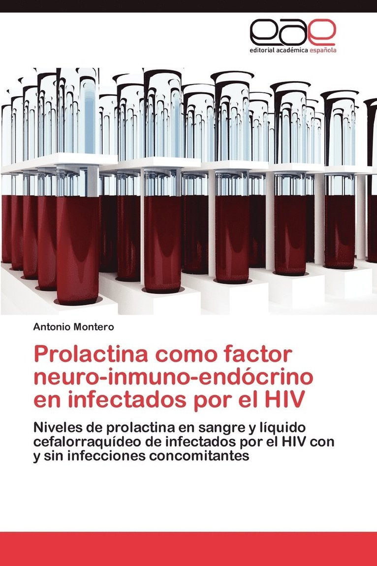 Prolactina Como Factor Neuro-Inmuno-Endocrino En Infectados Por El HIV 1