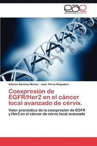 bokomslag Coexpresion de Egfr/Her2 En El Cancer Local Avanzado de Cervix.