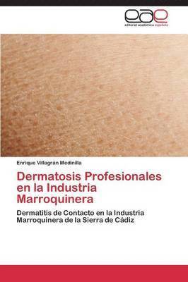 Dermatosis Profesionales En La Industria Marroquinera 1