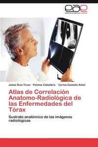 bokomslag Atlas de Correlacin Anatomo-Radiolgica de las Enfermedades del Trax