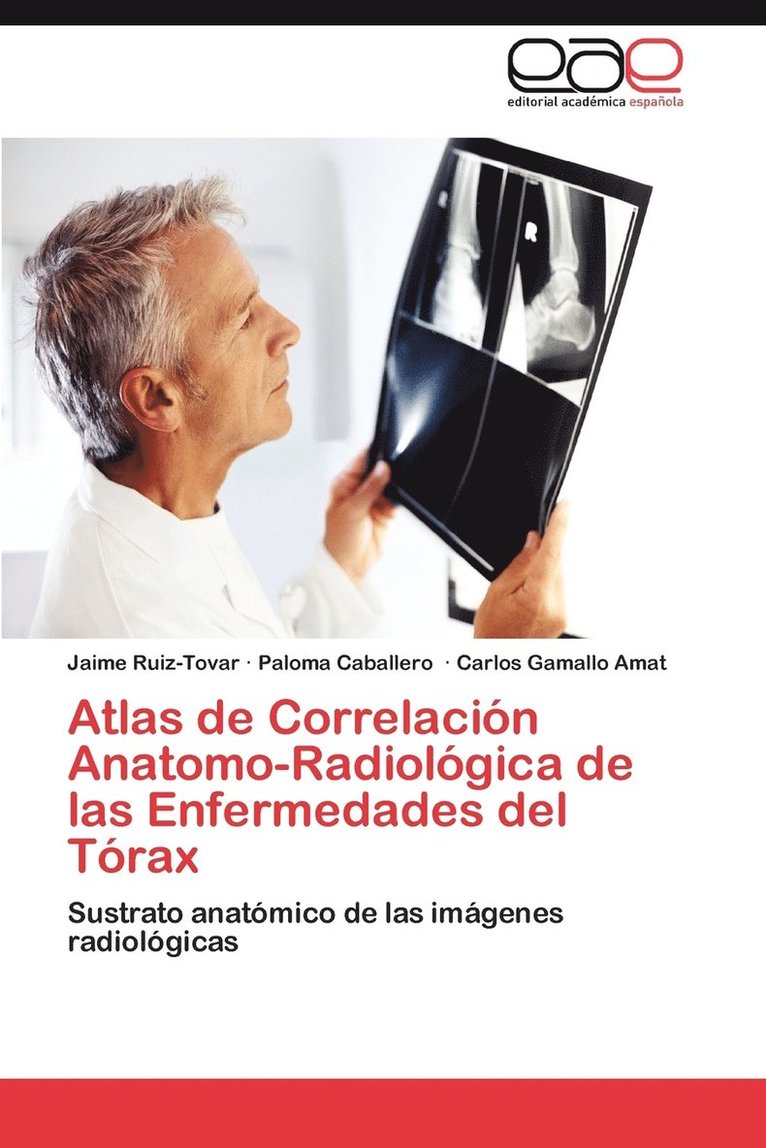 Atlas de Correlacin Anatomo-Radiolgica de las Enfermedades del Trax 1