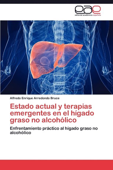 bokomslag Estado Actual y Terapias Emergentes En El Higado Graso No Alcoholico