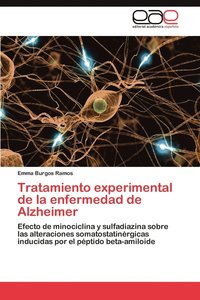 bokomslag Tratamiento experimental de la enfermedad de Alzheimer