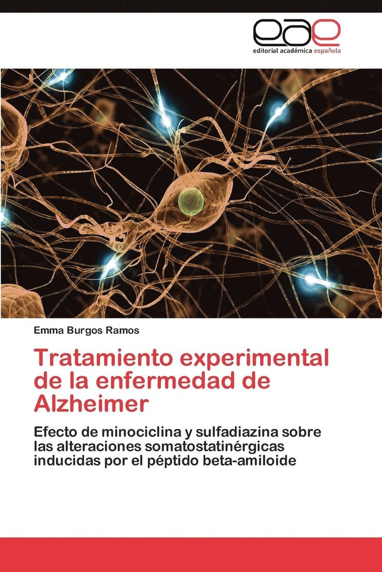 Tratamiento experimental de la enfermedad de Alzheimer 1