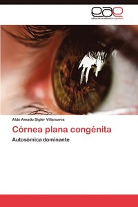 bokomslag Cornea Plana Congenita