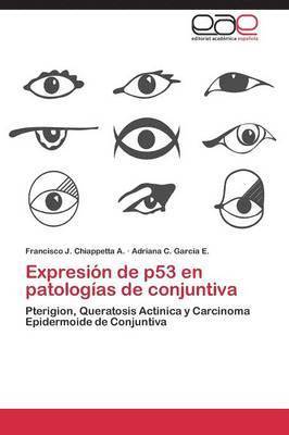 Expresion de P53 En Patologias de Conjuntiva 1