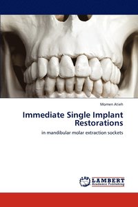 bokomslag Immediate Single Implant Restorations