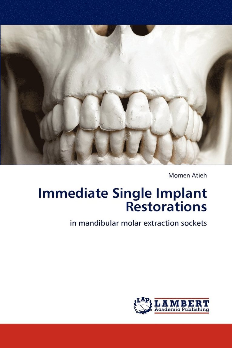 Immediate Single Implant Restorations 1