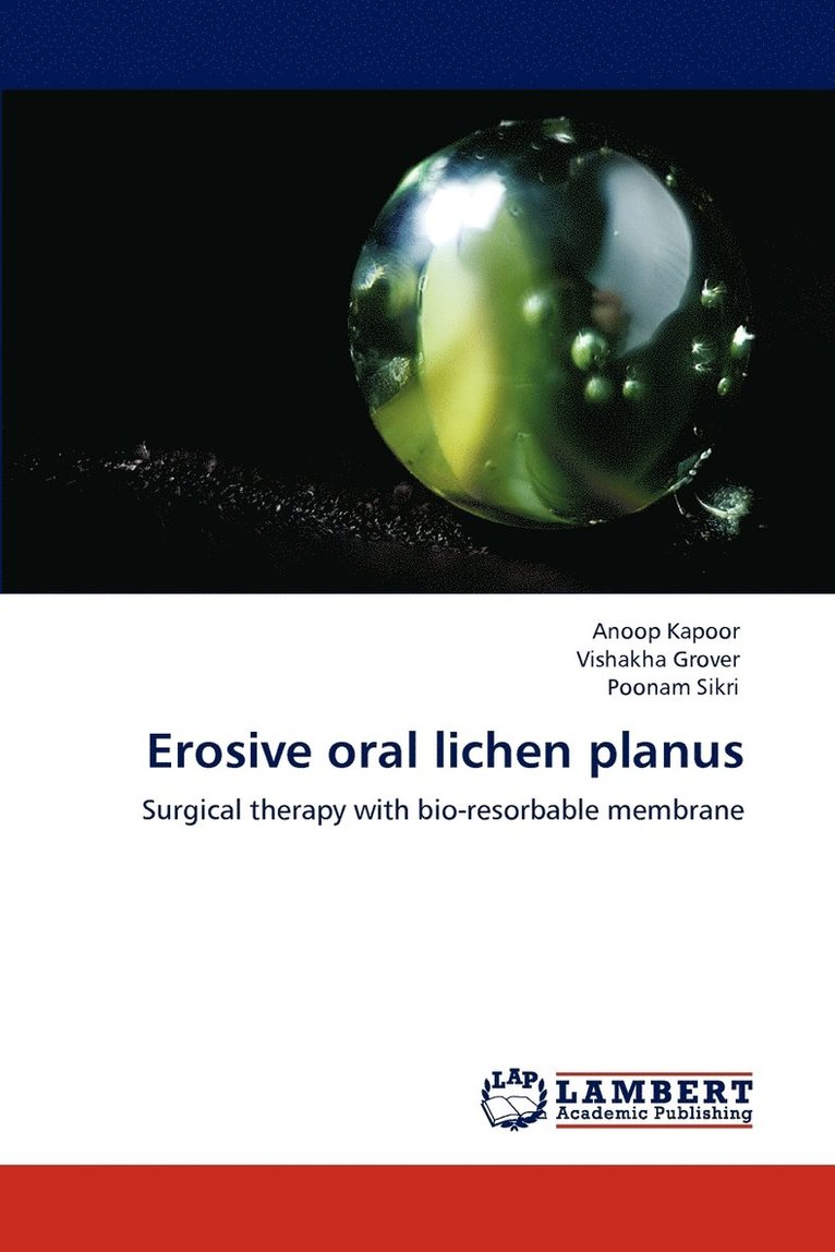 Erosive oral lichen planus 1