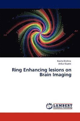 Ring Enhancing Lesions on Brain Imaging 1