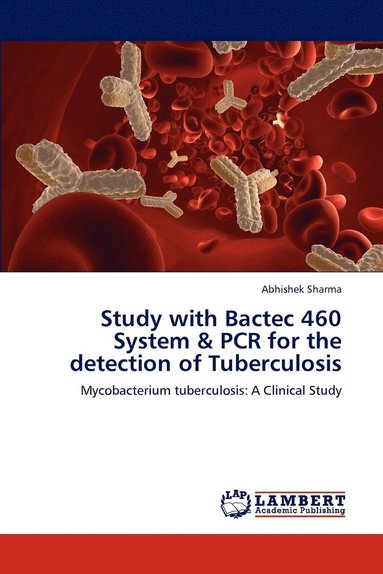 bokomslag Study with Bactec 460 System & PCR for the detection of Tuberculosis