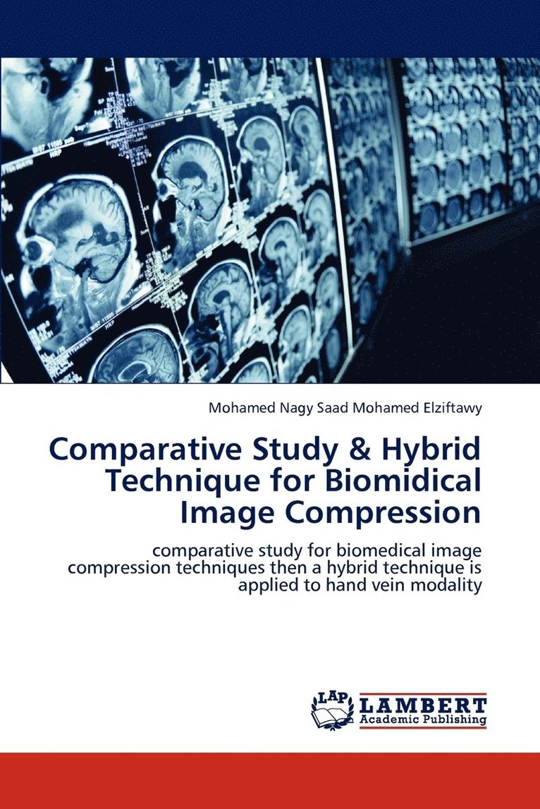 Comparative Study & Hybrid Technique for Biomidical Image Compression 1