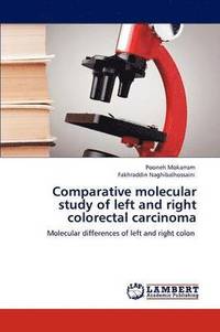 bokomslag Comparative molecular study of left and right colorectal carcinoma